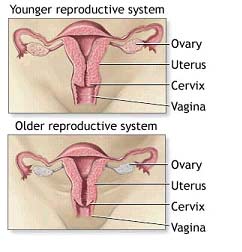 menopause