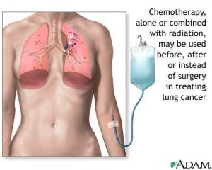 Lung Cancer and Treatments