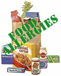 Food Allergies Food Allergies