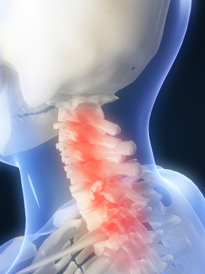 Neck pain Neck pain